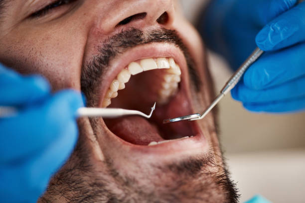 Best Emergency Treatment for Toothache in Untain Grove, MO