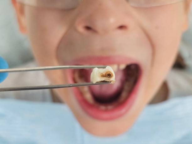 Best After-Hours Emergency Dentist in Untain Grove, MO